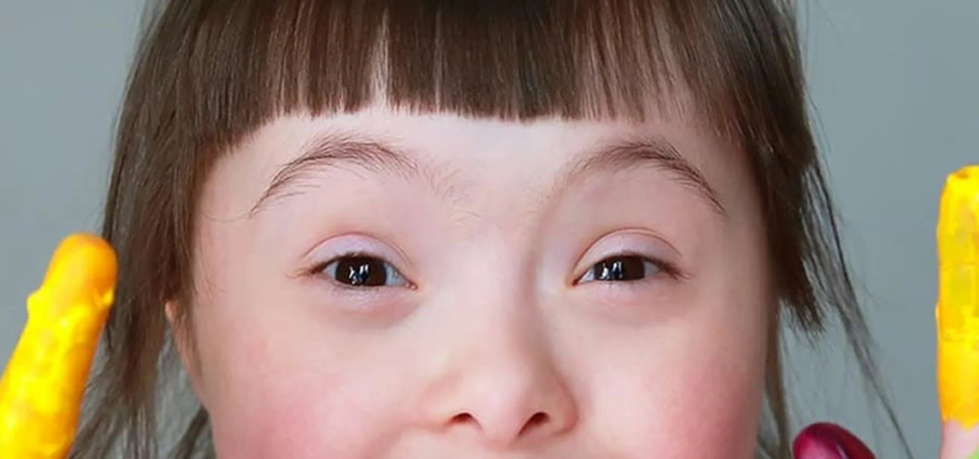 A child with Down syndrome holding painted palms open towards the camera.